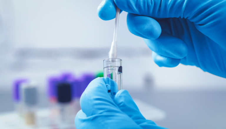lab test at labcorp
